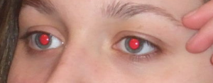 yeux_rouges